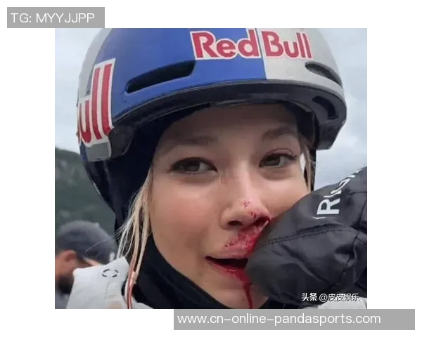 国籍争议水落石出1年后，22岁谷爱凌近况曝光，伤病中备战冬奥